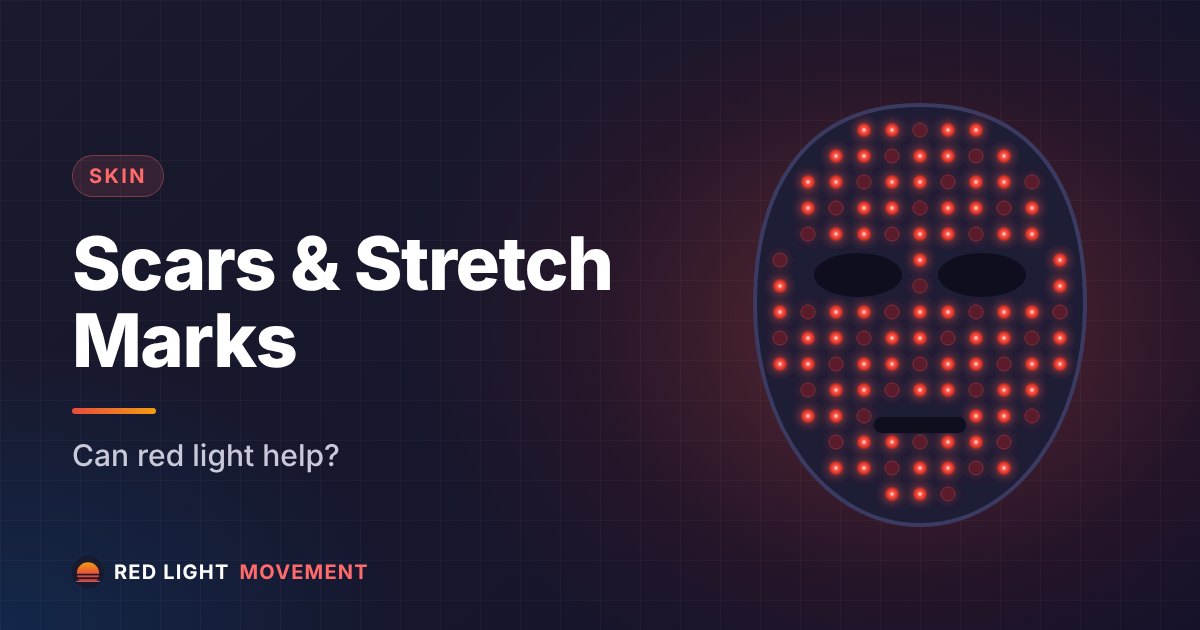 Red Light Therapy for Scars & Stretch Marks: Full Guide